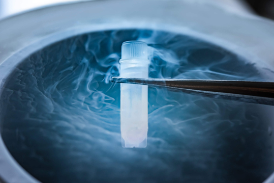 Cryopreservation of Human Gametes
