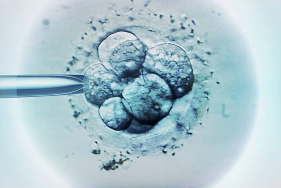 Fresh Embryo Transfer