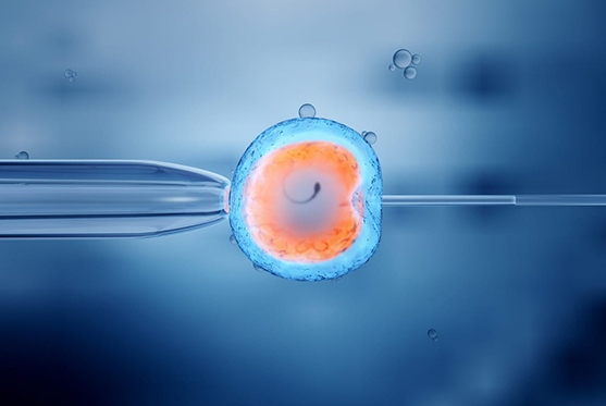 In Vitro Fertilization - IVF Treatment